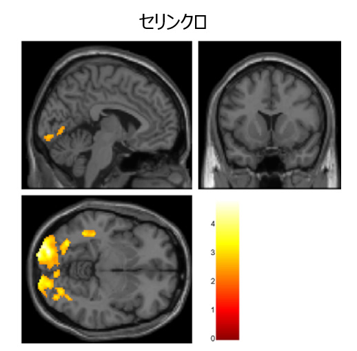 セリンクロの抑制効果